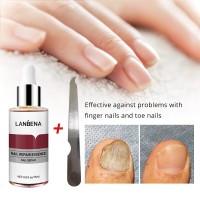 LANBENA Nail Repair Essence Serum Fungal Nail Treatment Remove Onychomycosis Toe Nourishing Brighten Hand Foot Skin Care
